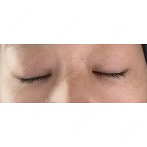 大塚美容形成外科 大塚美容形成外科 銀座本院口コミ