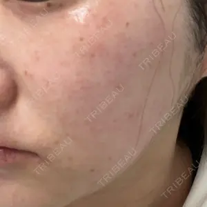 BISIN GINZA CLINIC口コミ