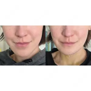 銀座マイアミ美容外科の