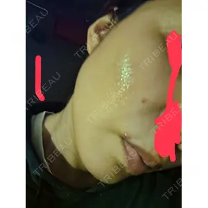 APスキンクリニック銀座口コミ