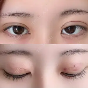 アイビークリニック 吉祥寺アイビークリニック口コミ