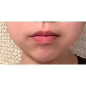 銀座みゆき通り美容外科の口コミ