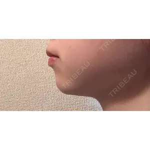 銀座みゆき通り美容外科の口コミ