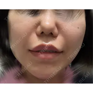 TCB東京中央美容外科 TCB東京中央美容外科 高崎院口コミ