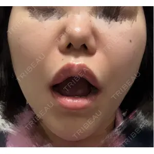 TCB東京中央美容外科 TCB東京中央美容外科 高崎院口コミ