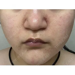 東京美容皮膚科アロエクリニック 東京美容皮膚科アロエクリニック池袋口コミ