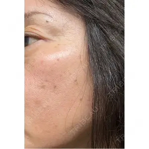 東京美容皮膚科アロエクリニック 東京美容皮膚科アロエクリニック池袋口コミ