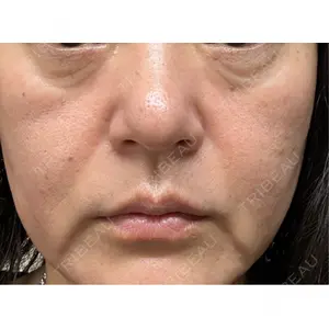 東京美容皮膚科アロエクリニック 東京美容皮膚科アロエクリニック池袋口コミ