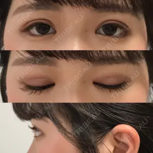 中央クリニック 大阪梅田中央クリニック美容外科口コミ