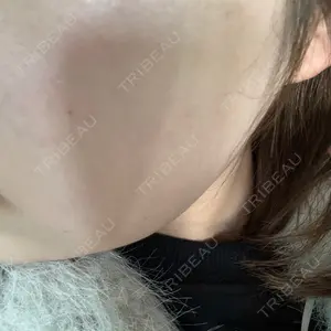 美容皮膚科ティファクリニック 美容皮膚科ティファクリニック 新宿東口口コミ