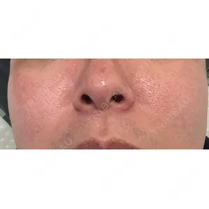 Fellez Clinic【フェルズクリニック】口コミ