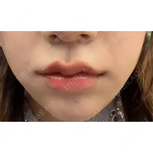 ルラ美容クリニック ルラ美容クリニック 渋谷本院口コミ