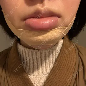 大塚美容形成外科 大塚美容形成外科 銀座本院口コミ