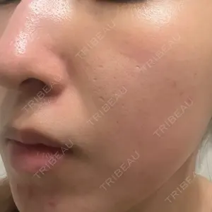 BBC BBC表参道院口コミ