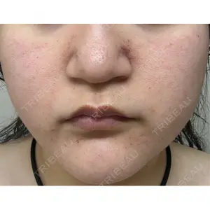 東京美容皮膚科アロエクリニック 東京美容皮膚科アロエクリニック池袋口コミ