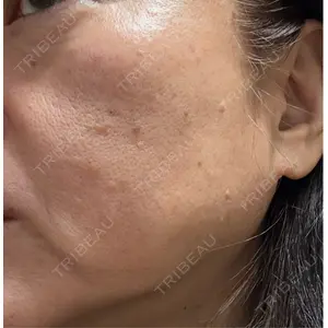 東京美容皮膚科アロエクリニック 東京美容皮膚科アロエクリニック池袋口コミ