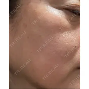 東京美容皮膚科アロエクリニック 東京美容皮膚科アロエクリニック池袋口コミ