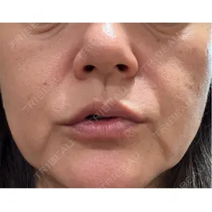 東京美容皮膚科アロエクリニック 東京美容皮膚科アロエクリニック池袋口コミ