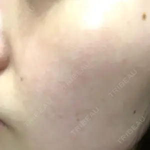 東京美容皮膚科アロエクリニック 東京美容皮膚科アロエクリニック池袋口コミ