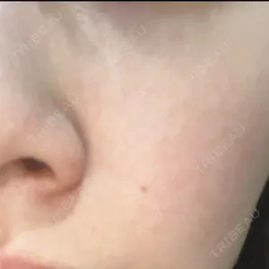 東京美容皮膚科アロエクリニック 東京美容皮膚科アロエクリニック池袋口コミ