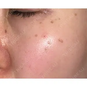 APスキンクリニック銀座口コミ