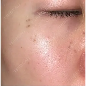 APスキンクリニック銀座口コミ