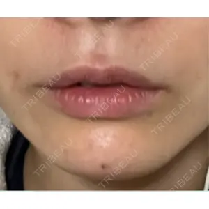 ヴェリテクリニック ヴェリテクリニック 銀座院口コミ