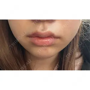 ルラ美容クリニック ルラ美容クリニック 渋谷本院口コミ