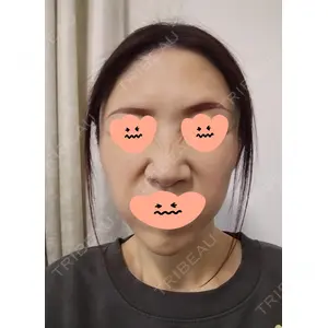 白金ビークリニック 本院口コミ