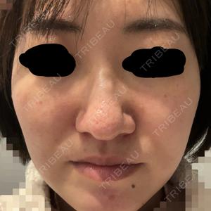 ブリリアスキンクリニック口コミ