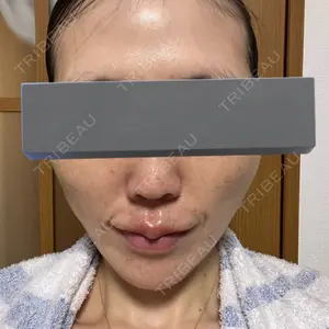 口コミ
