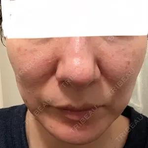 東京美容皮膚科アロエクリニック 東京美容皮膚科アロエクリニック池袋口コミ