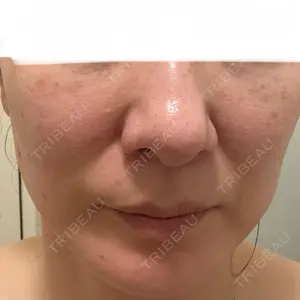 東京美容皮膚科アロエクリニック 東京美容皮膚科アロエクリニック池袋口コミ