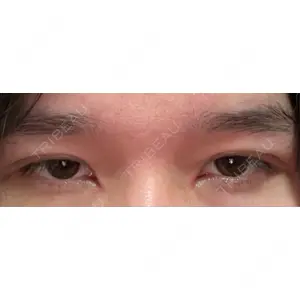 東京イセアクリニック口コミ