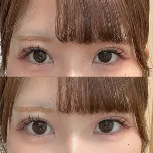 パルム美容クリニック口コミ