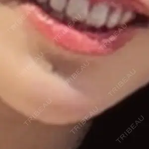 プロクリニック PRO CLINIC プロクリニック 銀座院口コミ
