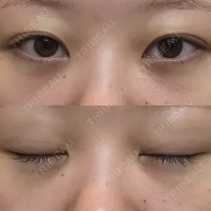 湘南美容クリニック 湘南美容クリニック 千葉センシティ院口コミ