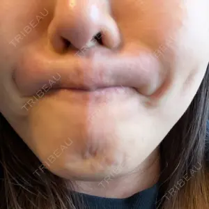 東京美容皮膚科アロエクリニック 東京美容皮膚科アロエクリニック池袋口コミ