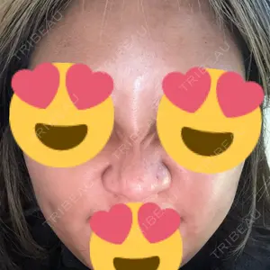 TCB東京中央美容外科 TCB東京中央美容外科 岐阜院口コミ