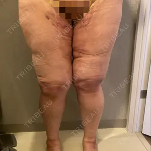 GAYA body design clinic口コミ