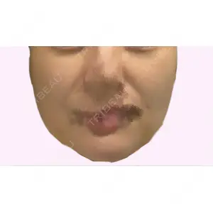 4Dクリニック口コミ