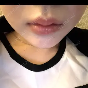 ルラ美容クリニック ルラ美容クリニック 札幌本院口コミ