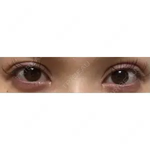 東京シンデレラ美容外科 東京シンデレラ美容外科 池袋院口コミ