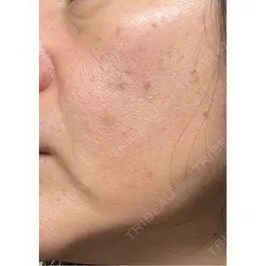 東京美容皮膚科アロエクリニック 東京美容皮膚科アロエクリニック池袋口コミ