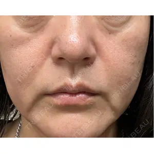 東京美容皮膚科アロエクリニック 東京美容皮膚科アロエクリニック池袋口コミ