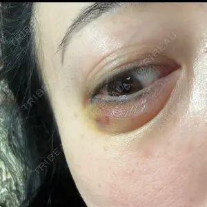 美容皮膚科ティファクリニック 美容皮膚科ティファクリニック 新宿東口口コミ