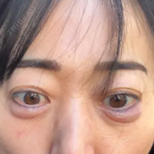 美容皮膚科ティファクリニック 美容皮膚科ティファクリニック 新宿東口口コミ