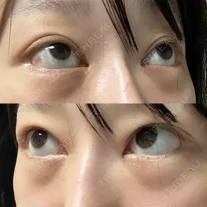 LEX BEAUTY CLINIC LEX BEAUTY CLINIC口コミ