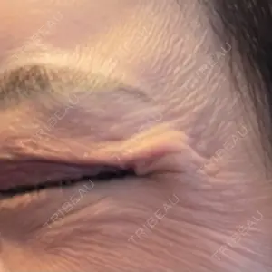 東京美容皮膚科アロエクリニック 東京美容皮膚科アロエクリニック池袋口コミ