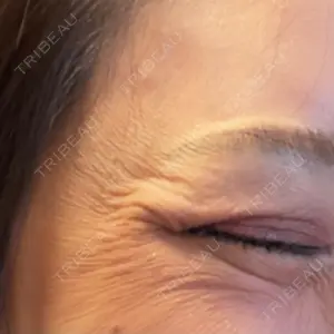 東京美容皮膚科アロエクリニック 東京美容皮膚科アロエクリニック池袋口コミ